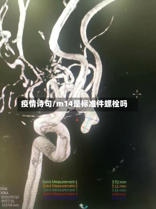 疫情诗句/m14是标准件螺栓吗