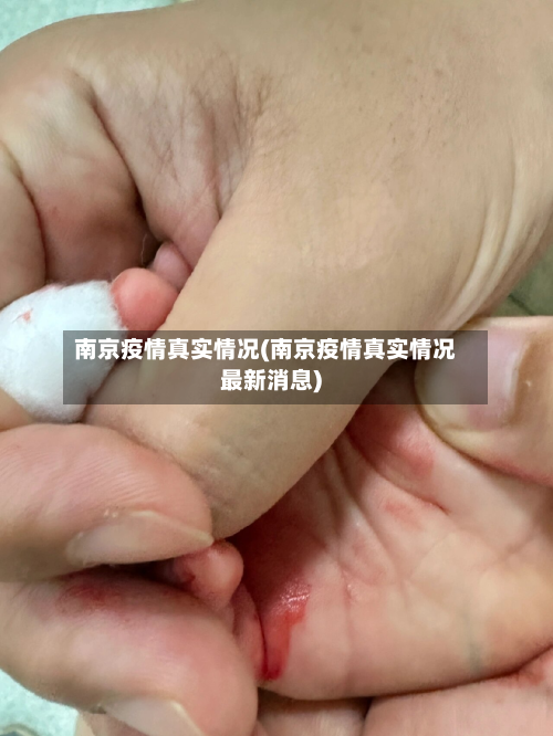 南京疫情真实情况(南京疫情真实情况最新消息)-第2张图片