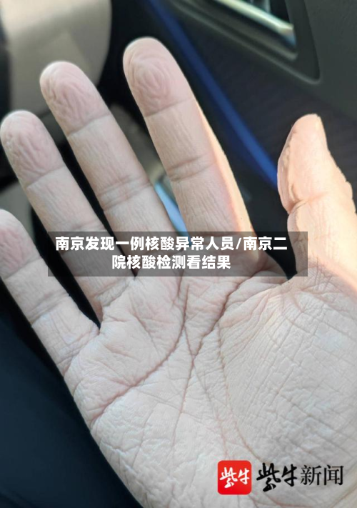 南京发现一例核酸异常人员/南京二院核酸检测看结果-第2张图片